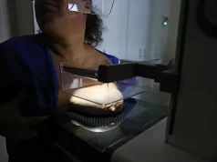 ANS defende que plano cubra mamografia digital sem restrição de idade