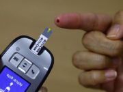 Estudo da Fiocruz analisa inflamação na covid-19 grave em diabéticos