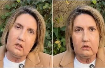 Transplante facial: mulher doa rosto antes de morrer na Espanha