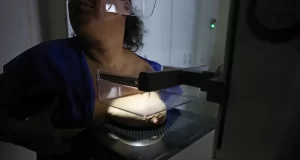 ANS defende que plano cubra mamografia digital sem restrição de idade